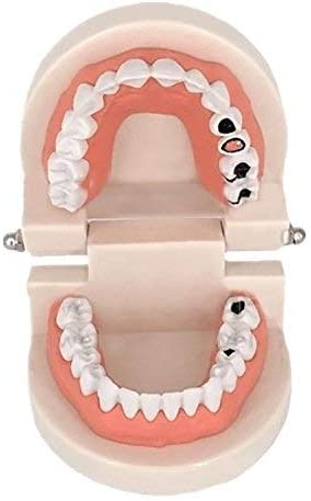 Easyinsmile lazy tooth model *standard tooth teaching model *sick tooth model for children and students